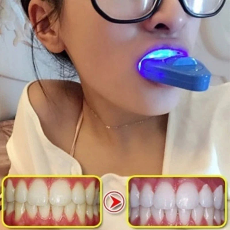 Teeth Light LED Blue Light Whitening Kit Teeth beauty Machine Utilizes Cold Light Technology Personal Dentals Treatments 