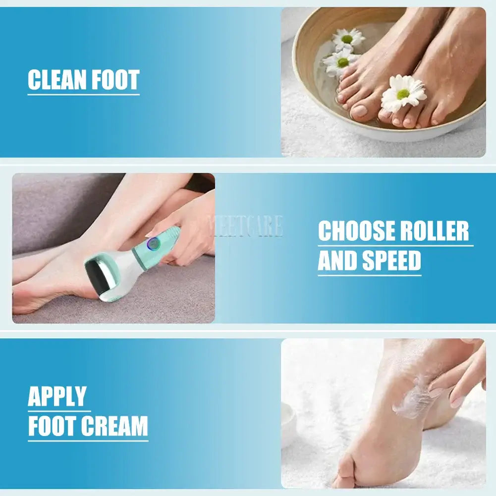 Wireless Foot Grinder USB Recharge Waterproof Anti Callus Dead Skin Cracks Pedicure Shaver Remove Dry Dead Cracked