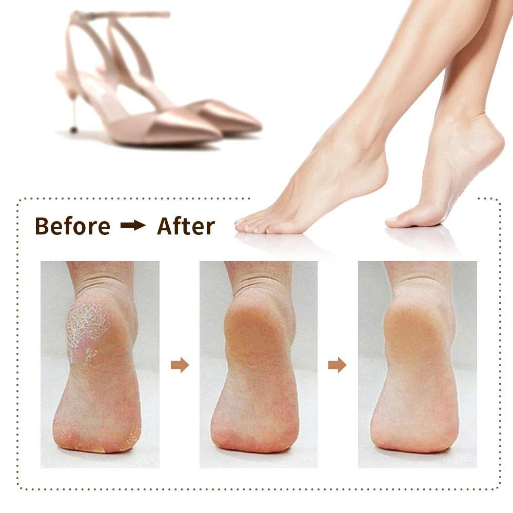 Hot sale Charged Electric Foot File for Heels Grinding Pedicure Tools Professional Foot Care Tool Dead Hard Skin Callus Remover