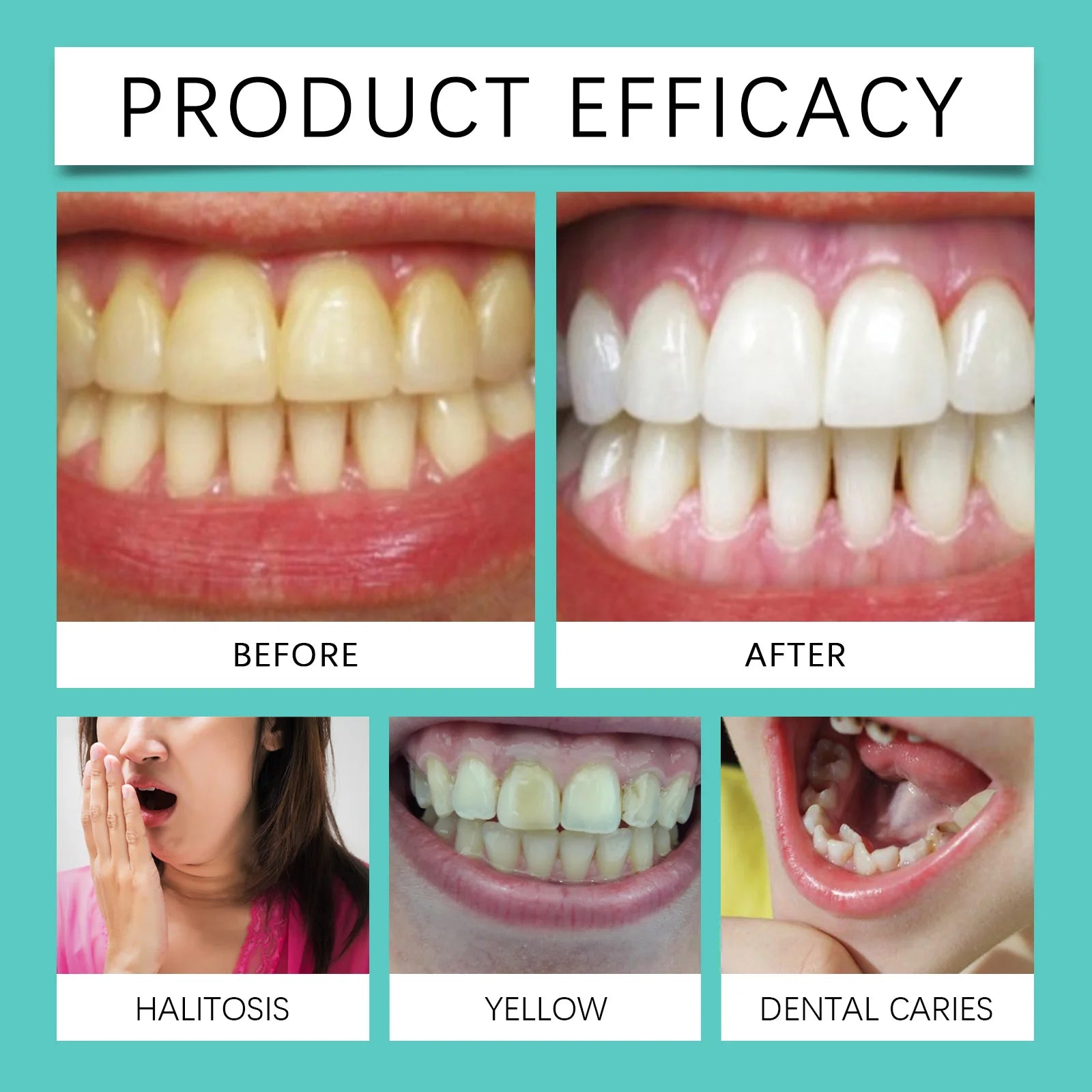 Tooth Whitening Strips Remove Tooth Stains Tartar Plaque Lighten Dark Dental Cleaning Improve Bad Breath Bleach Teeth Brightener