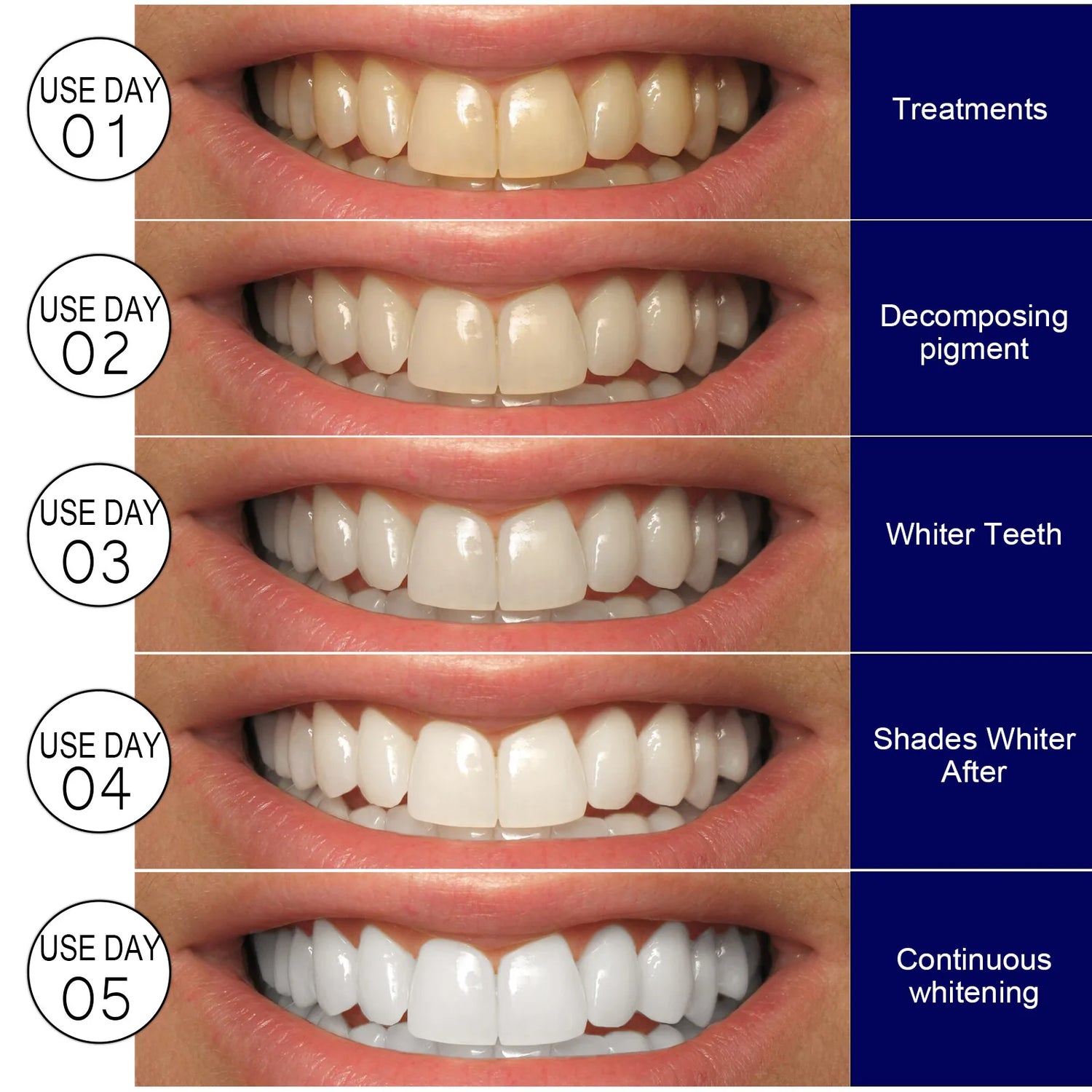 Teeth Whitening Stickers Mint White Teeth Gel Tooth Whitener Strips Teeth Yellow Smoke Stains Tea Stains Oral Hygiene Care