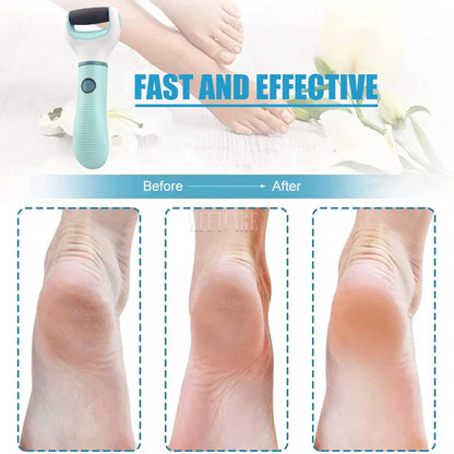 Wireless Foot Grinder USB Recharge Waterproof Anti Callus Dead Skin Cracks Pedicure Shaver Remove Dry Dead Cracked